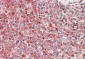 PRKCB Antibody (internal region, near C-Term)